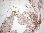 LGALS9 Antibody in Immunohistochemistry (Paraffin) (IHC (P))