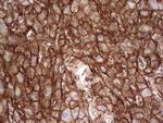 LGALS9 Antibody in Immunohistochemistry (Paraffin) (IHC (P))