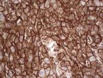 LGALS9 Antibody in Immunohistochemistry (Paraffin) (IHC (P))