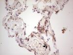 LGALS9 Antibody in Immunohistochemistry (Paraffin) (IHC (P))