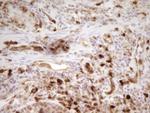 LGALS9 Antibody in Immunohistochemistry (Paraffin) (IHC (P))