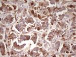 LGALS9 Antibody in Immunohistochemistry (Paraffin) (IHC (P))