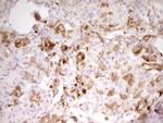 LGALS9 Antibody in Immunohistochemistry (Paraffin) (IHC (P))