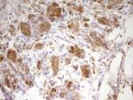 LGALS9 Antibody in Immunohistochemistry (Paraffin) (IHC (P))