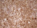 LGALS9 Antibody in Immunohistochemistry (Paraffin) (IHC (P))