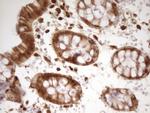 LGALS9 Antibody in Immunohistochemistry (Paraffin) (IHC (P))