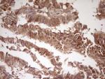 LGALS9 Antibody in Immunohistochemistry (Paraffin) (IHC (P))