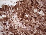 LGALS9 Antibody in Immunohistochemistry (Paraffin) (IHC (P))