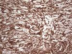 LGALS9 Antibody in Immunohistochemistry (Paraffin) (IHC (P))