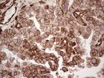 LGALS9 Antibody in Immunohistochemistry (Paraffin) (IHC (P))