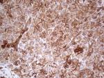 LGALS9 Antibody in Immunohistochemistry (Paraffin) (IHC (P))