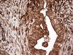 LGALS9 Antibody in Immunohistochemistry (Paraffin) (IHC (P))