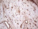 LGALS9 Antibody in Immunohistochemistry (Paraffin) (IHC (P))