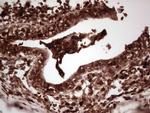 LGALS9 Antibody in Immunohistochemistry (Paraffin) (IHC (P))