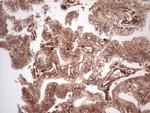 LGALS9 Antibody in Immunohistochemistry (Paraffin) (IHC (P))