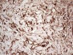 LGALS9 Antibody in Immunohistochemistry (Paraffin) (IHC (P))