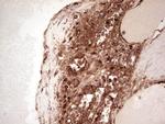 LGALS9 Antibody in Immunohistochemistry (Paraffin) (IHC (P))