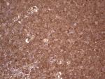 LGALS9 Antibody in Immunohistochemistry (Paraffin) (IHC (P))