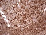 LGALS9 Antibody in Immunohistochemistry (Paraffin) (IHC (P))