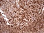 LGALS9 Antibody in Immunohistochemistry (Paraffin) (IHC (P))