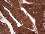 LGALS9 Antibody in Immunohistochemistry (Paraffin) (IHC (P))