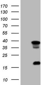 LGALS9 Antibody in Western Blot (WB)