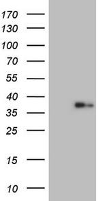 LGALS9 Antibody in Western Blot (WB)