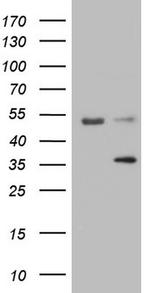 LGALS9 Antibody in Western Blot (WB)