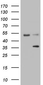 LGALS9 Antibody in Western Blot (WB)