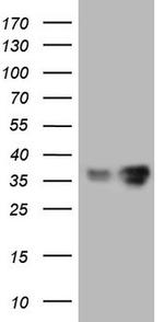 LGALS9 Antibody in Western Blot (WB)