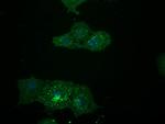 LGR5 Antibody in Immunocytochemistry (ICC/IF)