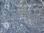 LGR5 Antibody in Immunohistochemistry (Paraffin) (IHC (P))