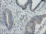 LGR5 Antibody in Immunohistochemistry (Paraffin) (IHC (P))