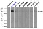 LGR5 Antibody in Immunoprecipitation (IP)