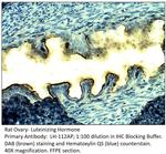 Luteinizing Hormone Antibody in Immunohistochemistry (IHC)