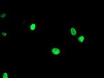 LHX1 Antibody in Immunocytochemistry (ICC/IF)