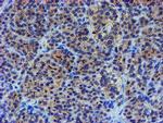 LHX1 Antibody in Immunohistochemistry (Paraffin) (IHC (P))