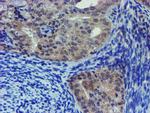 LHX1 Antibody in Immunohistochemistry (Paraffin) (IHC (P))