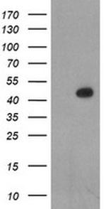 LHX1 Antibody in Western Blot (WB)