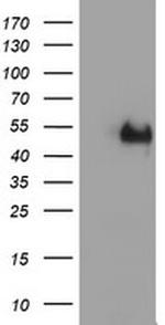 LHX1 Antibody in Western Blot (WB)