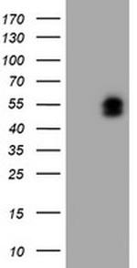 LHX1 Antibody in Western Blot (WB)