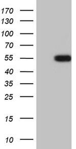 LHX2 Antibody in Western Blot (WB)