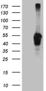 LHX2 Antibody in Western Blot (WB)