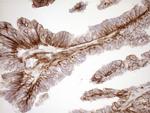 LIMA1 Antibody in Immunohistochemistry (Paraffin) (IHC (P))