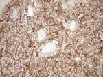 LIMA1 Antibody in Immunohistochemistry (Paraffin) (IHC (P))