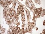 LIMA1 Antibody in Immunohistochemistry (Paraffin) (IHC (P))