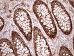 LIMA1 Antibody in Immunohistochemistry (Paraffin) (IHC (P))