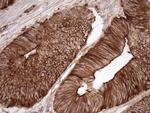 LIMA1 Antibody in Immunohistochemistry (Paraffin) (IHC (P))