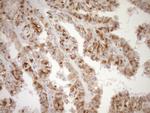 LIMA1 Antibody in Immunohistochemistry (Paraffin) (IHC (P))