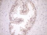 LIMA1 Antibody in Immunohistochemistry (Paraffin) (IHC (P))